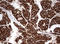 Ornithine Carbamoyltransferase antibody, LS-C336604, Lifespan Biosciences, Immunohistochemistry paraffin image 