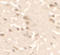 Unc-51 Like Autophagy Activating Kinase 2 antibody, A05219-1, Boster Biological Technology, Immunohistochemistry paraffin image 