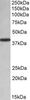 Synaptosome Associated Protein 23 antibody, 42-631, ProSci, Enzyme Linked Immunosorbent Assay image 