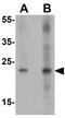 High Mobility Group Box 1 antibody, GTX31912, GeneTex, Western Blot image 