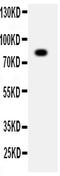 ADAM Metallopeptidase Domain 2 antibody, PA2069, Boster Biological Technology, Western Blot image 