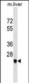 Sarcoglycan Delta antibody, PA5-48734, Invitrogen Antibodies, Western Blot image 