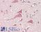 Fibroblast Growth Factor 10 antibody, LS-B13752, Lifespan Biosciences, Immunohistochemistry paraffin image 
