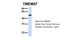 Macoilin 1 antibody, 26-223, ProSci, Western Blot image 