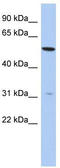 Transmembrane Protein 161B antibody, TA337836, Origene, Western Blot image 