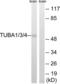 Tubulin Alpha 1a antibody, abx013002, Abbexa, Western Blot image 