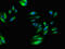 Serine/threonine-protein phosphatase 6 catalytic subunit antibody, LS-C679131, Lifespan Biosciences, Immunofluorescence image 