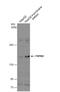 Transient Receptor Potential Cation Channel Subfamily M Member 2 antibody, NBP1-33416, Novus Biologicals, Western Blot image 