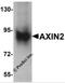 Axin 2 antibody, 6163, ProSci, Western Blot image 