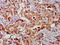 Growth Arrest Specific 2 antibody, LS-C395777, Lifespan Biosciences, Immunohistochemistry paraffin image 