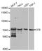 Complement Factor B antibody, A1706, ABclonal Technology, Western Blot image 