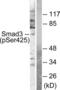 SMAD Family Member 3 antibody, LS-C199588, Lifespan Biosciences, Western Blot image 