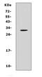 Interleukin 17F antibody, A02062-3, Boster Biological Technology, Western Blot image 