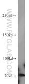 ACK1 antibody, 14304-1-AP, Proteintech Group, Western Blot image 