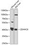 Zinc Finger DHHC-Type Containing 9 antibody, 23-323, ProSci, Western Blot image 