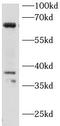 Interleukin 1 Receptor Associated Kinase 3 antibody, FNab10159, FineTest, Western Blot image 