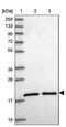 Ubiquitin Conjugating Enzyme E2 G1 antibody, PA5-61069, Invitrogen Antibodies, Western Blot image 