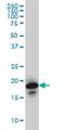 Nudix Hydrolase 10 antibody, H00170685-M01, Novus Biologicals, Western Blot image 