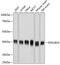 DnaJ Heat Shock Protein Family (Hsp40) Member B14 antibody, GTX65594, GeneTex, Western Blot image 