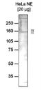Remodeling And Spacing Factor 1 antibody, NBP2-59281, Novus Biologicals, Western Blot image 