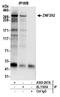 Zinc Finger Protein 292 antibody, A303-267A, Bethyl Labs, Immunoprecipitation image 