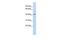 Epithelial Stromal Interaction 1 antibody, GTX46237, GeneTex, Western Blot image 