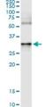 Annexin A3 antibody, H00000306-M07, Novus Biologicals, Immunoprecipitation image 