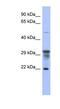 Phosphomannomutase 1 antibody, NBP1-55475, Novus Biologicals, Western Blot image 