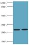 Ubiquitin Conjugating Enzyme E2 J2 antibody, MBS1495014, MyBioSource, Western Blot image 