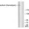 Sodium channel protein type 5 subunit alpha antibody, PA5-49751, Invitrogen Antibodies, Western Blot image 