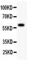 ATM Serine/Threonine Kinase antibody, RP1040, Boster Biological Technology, Western Blot image 