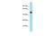 Enhancer Of MRNA Decapping 3 antibody, PA5-45627, Invitrogen Antibodies, Western Blot image 