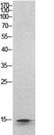 Histone Cluster 1 H2B Family Member B antibody, A12718, Boster Biological Technology, Western Blot image 