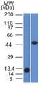 Perilipin 2 antibody, GTX34395, GeneTex, Western Blot image 