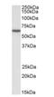 Karyopherin Subunit Alpha 3 antibody, NB100-1373, Novus Biologicals, Western Blot image 
