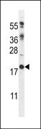 Regulator Of Calcineurin 2 antibody, PA5-72458, Invitrogen Antibodies, Western Blot image 