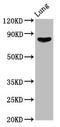 ITGB6 antibody, CSB-PA011890LA01HU, Cusabio, Western Blot image 