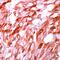 S100 Calcium Binding Protein A1 antibody, PA5-32575, Invitrogen Antibodies, Immunohistochemistry frozen image 