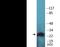 Thymidine Kinase 1 antibody, EKC2128, Boster Biological Technology, Western Blot image 