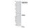 Acetyl-CoA Carboxylase Beta antibody, 11818S, Cell Signaling Technology, Western Blot image 