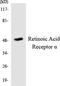 Retinoic Acid Receptor Alpha antibody, LS-C200586, Lifespan Biosciences, Western Blot image 