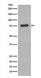 Bruton Tyrosine Kinase antibody, P00245-1, Boster Biological Technology, Western Blot image 