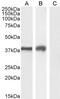 Adrenoceptor Beta 1 antibody, 45-211, ProSci, Western Blot image 