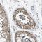 Pannexin 1 antibody, NBP1-92241, Novus Biologicals, Immunohistochemistry paraffin image 