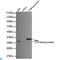 Interleukin 18 Binding Protein antibody, LS-C813015, Lifespan Biosciences, Western Blot image 