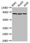 Heat Shock Protein 90 Alpha Family Class B Member 1 antibody, CSB-PA00109A0Rb, Cusabio, Western Blot image 