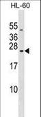 RAB20, Member RAS Oncogene Family antibody, LS-C158782, Lifespan Biosciences, Western Blot image 