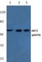 RAC-beta serine/threonine-protein kinase antibody, PA5-36819, Invitrogen Antibodies, Western Blot image 