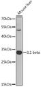 Interleukin 1 Beta antibody, GTX55675, GeneTex, Western Blot image 