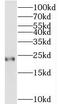 Transgelin 3 antibody, FNab08491, FineTest, Western Blot image 